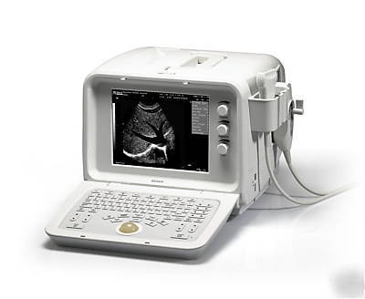 Digital ultrasound scanner fda approved