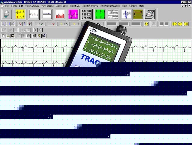 New reduced holter ecg analysis prog + 4 recorders